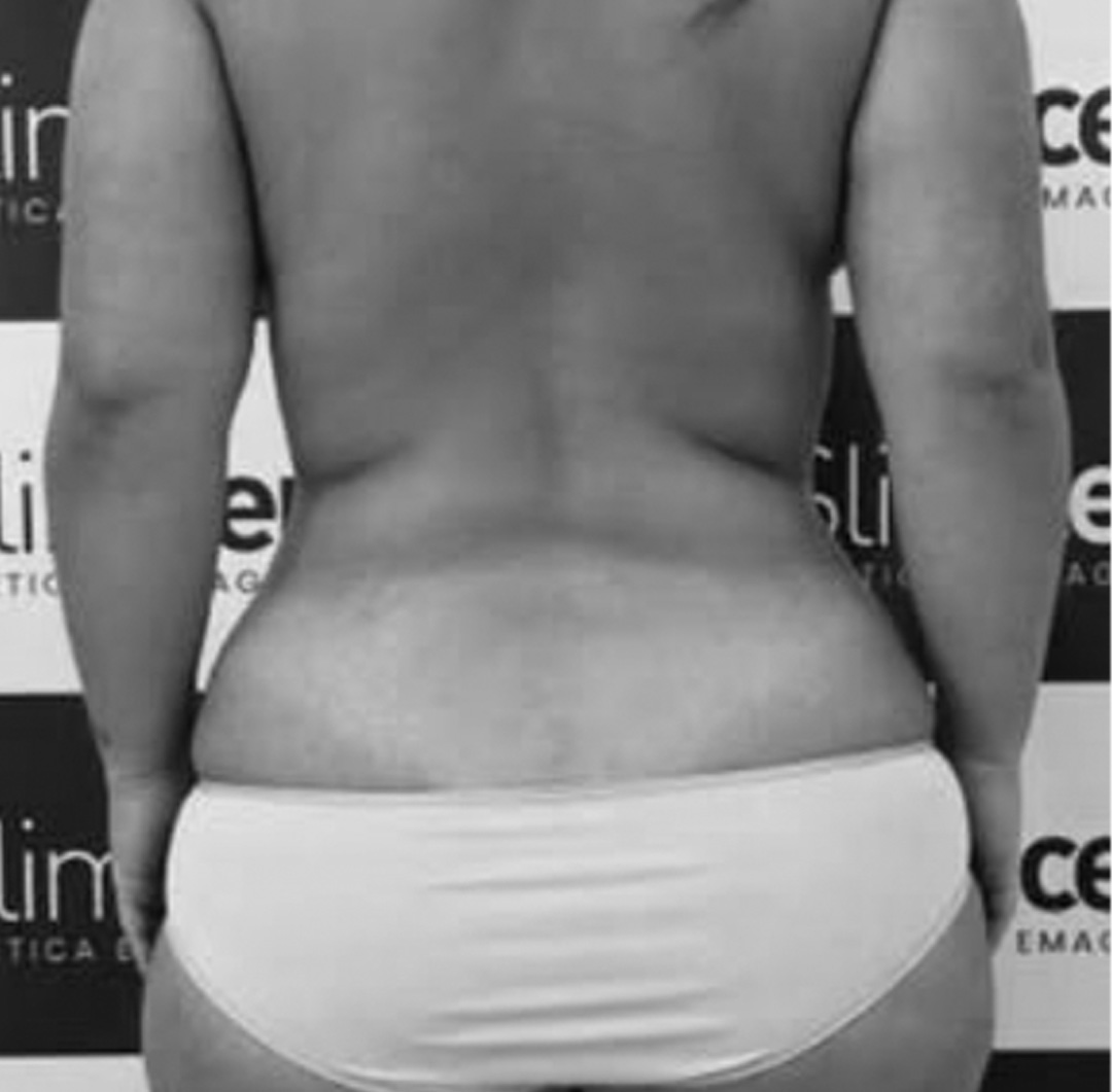 SLIM4_antes