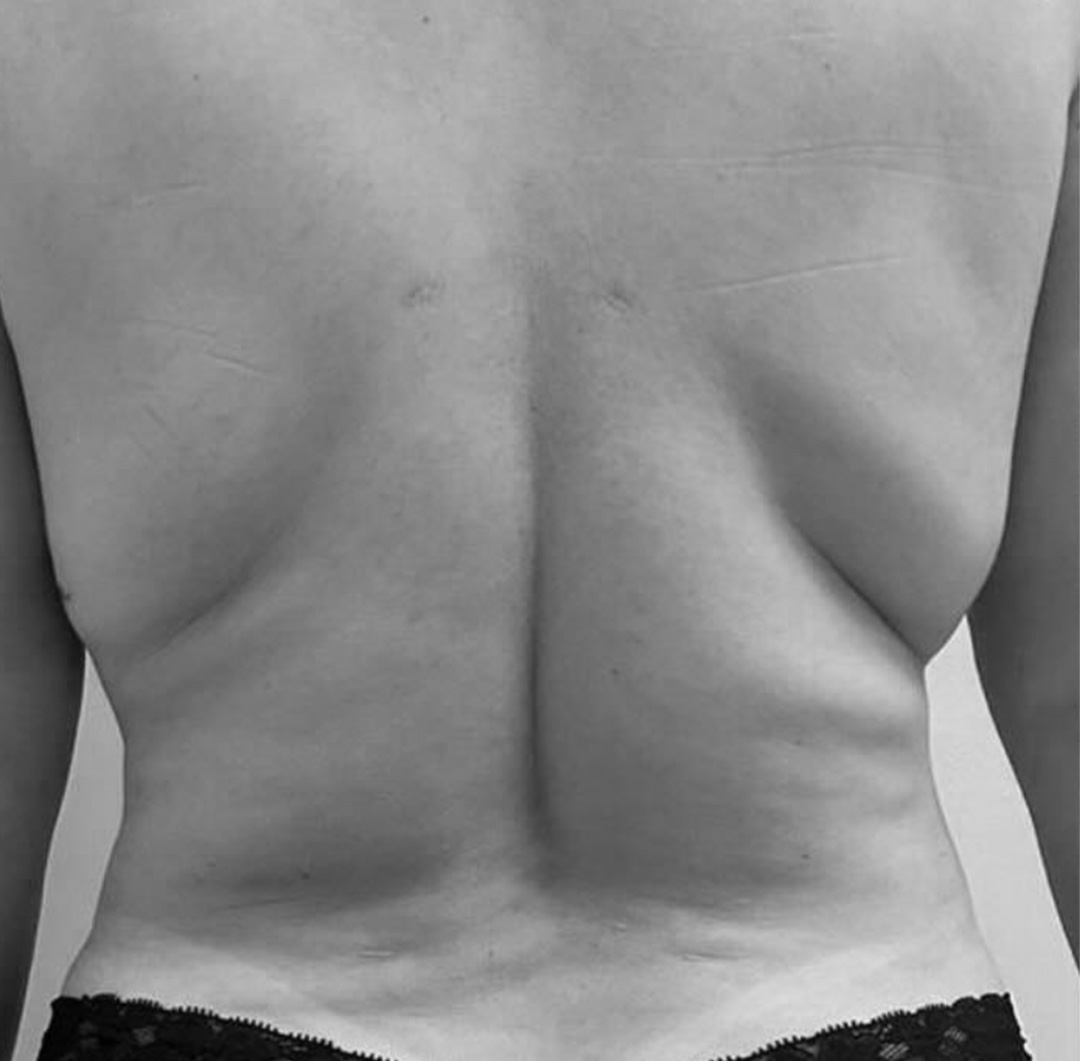 Sculp_antes