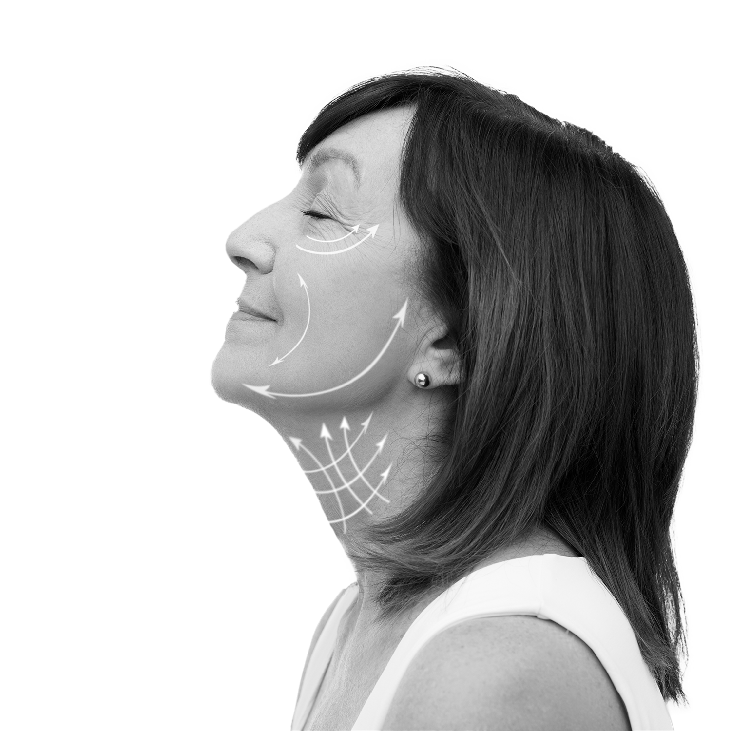 tratfacial_6
