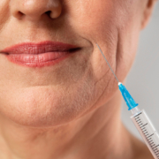 Preenchimento facial x Botox em Jundiaí