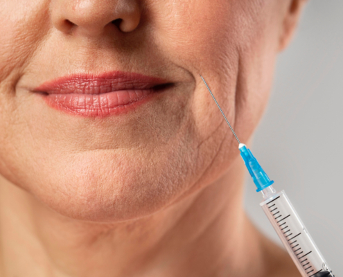 Preenchimento facial x Botox em Jundiaí