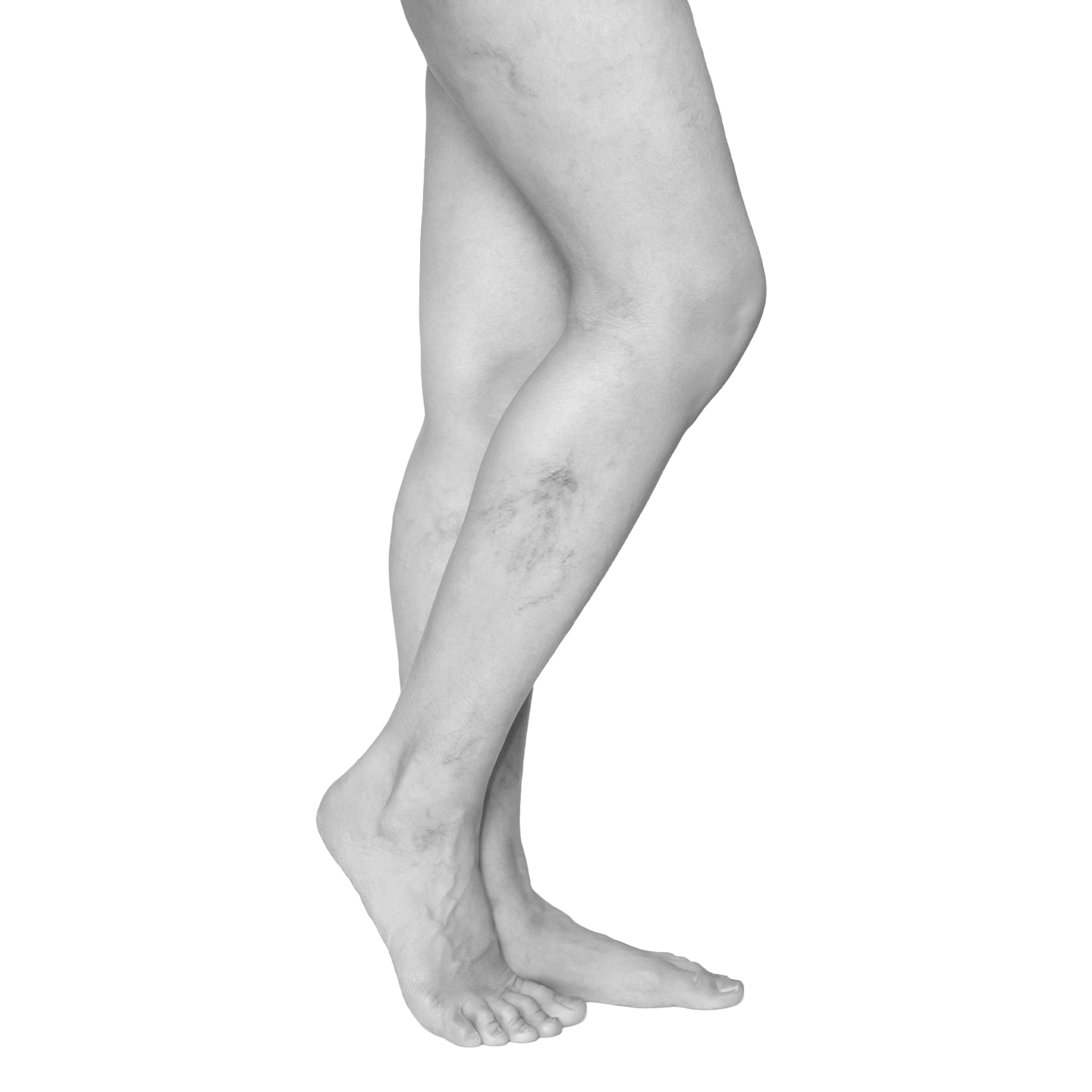 vasinhos