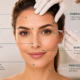 Áreas de aplicação do Botox para suavizar marcas de expressão com naturalidade.