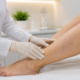 O que é escleroterapia