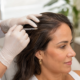 Profissional realizando mesoterapia capilar com aplicação no couro cabeludo.